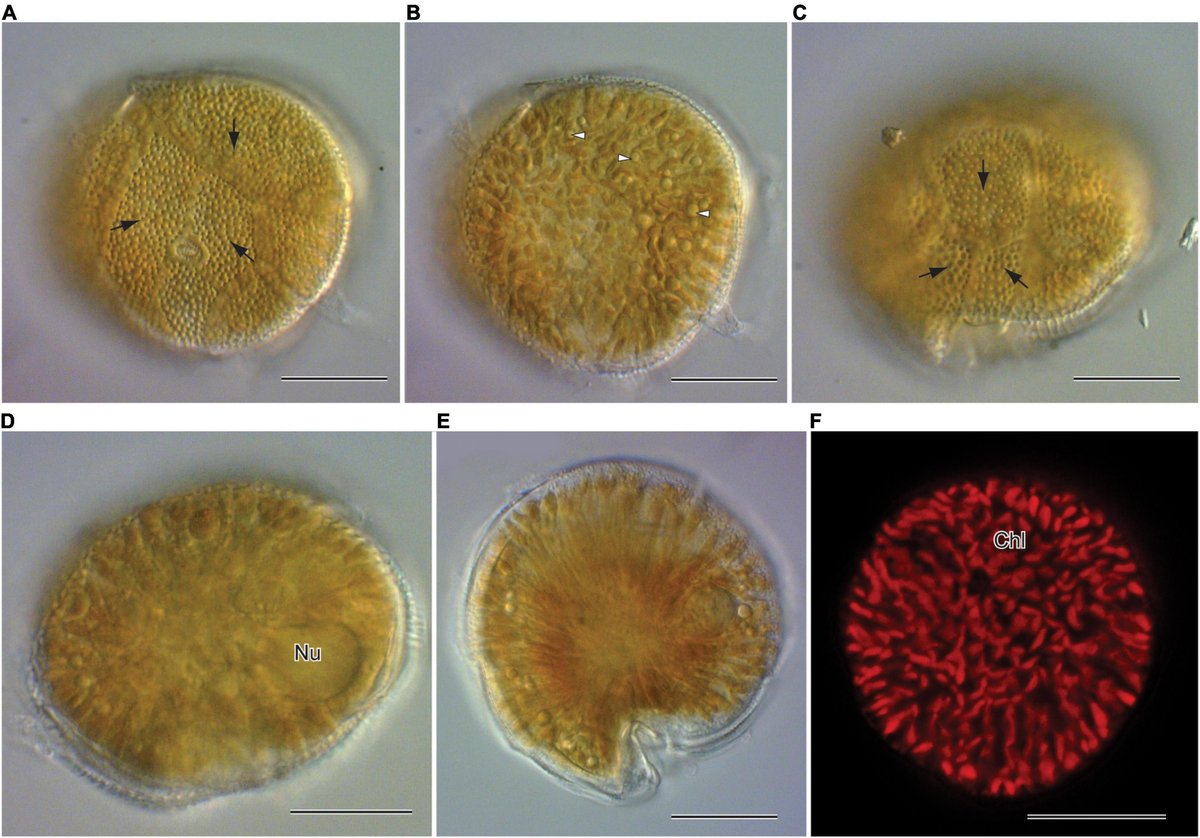 Detectan por Primera Vez una Microalga Tóxica en las Aguas del Mediterráneo Peninsular Español