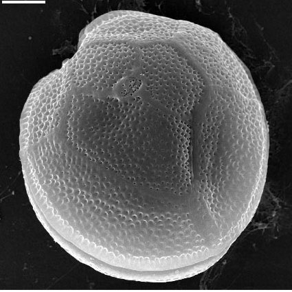 Detectan por Primera Vez una Microalga Tóxica en las Aguas del Mediterráneo Peninsular Español