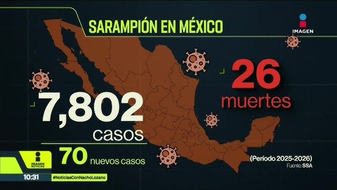 Vacunación contra el Sarampión en México: Ante un Brote en Ascenso