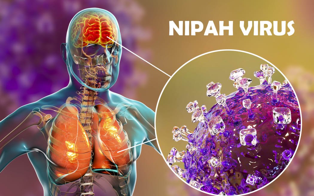 Virus Nipah en Tailandia: Alerta regional por el brote en India y medidas preventivas