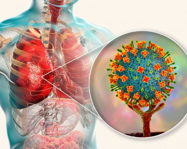 Virus Nipah en Tailandia: Alerta regional por el brote en India y medidas preventivas